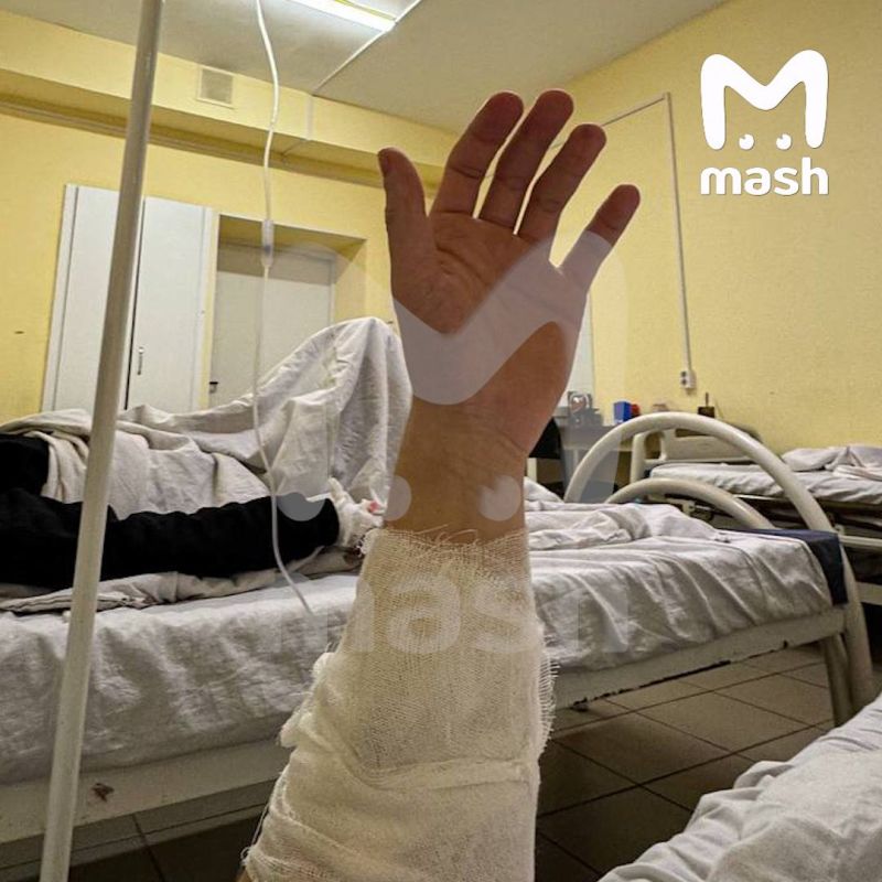 Боксёр из Ярославля попал в реанимацию после пачки суперострых чипсов с перцем