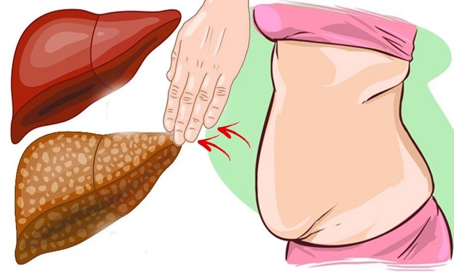 ������ ����� �������� ��������: ��� ������� �������� �� ������